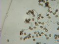 Sprouting pollen of n. jonquilla henriquesii (diploid)