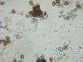Sprouting pollen of n. jonquilla henriquesii (tetraploid)